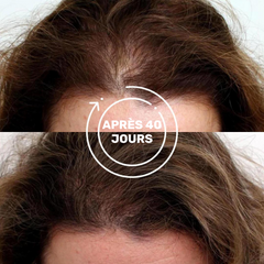 Sérum de repousse naturelle des cheveux - Forest & Shore
