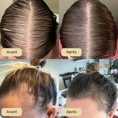 Sérum de repousse naturelle des cheveux - Forest & Shore